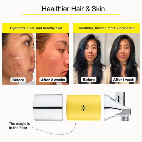 Afina shower filter hair-skin-benefit demonstrating softer hair and calmer skin