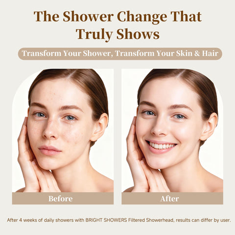 BRIGHT SHOWERS 360-degree swivel joint enables flexible angle adjustments during daily showers.