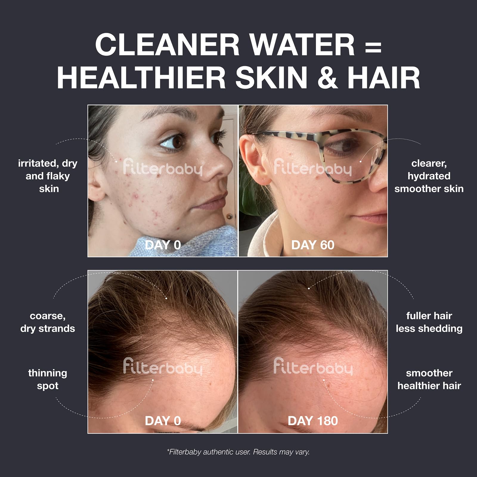 Filterbaby Diamond Series shower head water filter—skin and hair benefits.